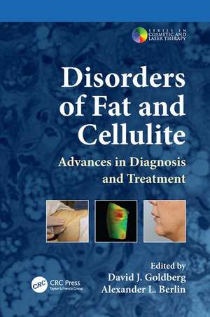 Disorders of Fat and Cellulite: Advances in Diagnosis and Treatment de David J. Goldberg