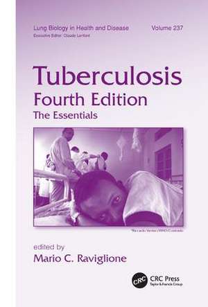 Tuberculosis: The Essentials, Fourth Edition de Mario C. Raviglione