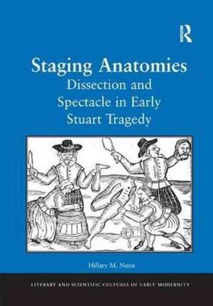 Staging Anatomies: Dissection and Spectacle in Early Stuart Tragedy de Hillary M. Nunn