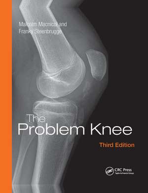 The Problem Knee de Malcolm Macnicol