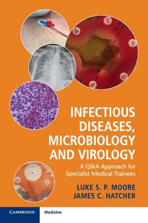 Infectious Diseases, Microbiology and Virology: A Q&A Approach for Specialist Medical Trainees de Luke S. P. Moore