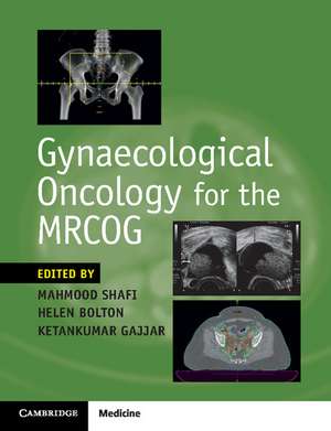 Gynaecological Oncology for the MRCOG de Mahmood Shafi