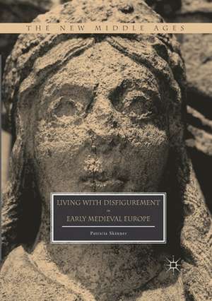 Living with Disfigurement in Early Medieval Europe de Patricia Skinner