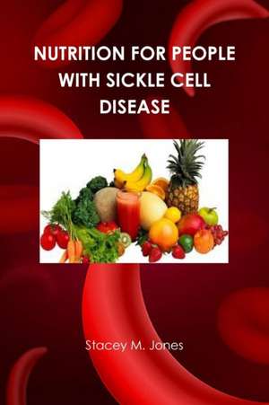 Nutrition for people with Sickle Cell Disease de Stacey Jones