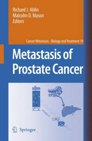 Metastasis of Prostate Cancer de Richard J. Ablin