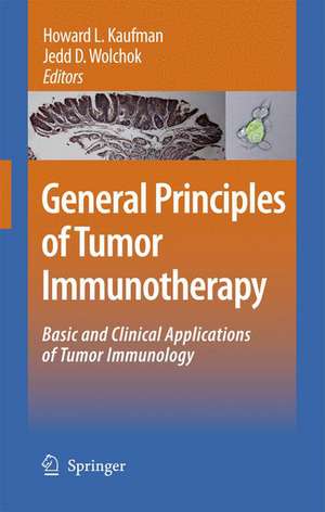 General Principles of Tumor Immunotherapy: Basic and Clinical Applications of Tumor Immunology de Howard L. Kaufman