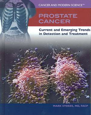 Prostate Cancer: Current and Emerging Trends in Detection and Treatment de Mark Stokes