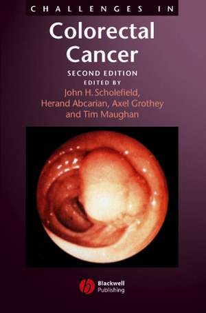 Challenges in Colorectal Cancer 2e de J Scholefield