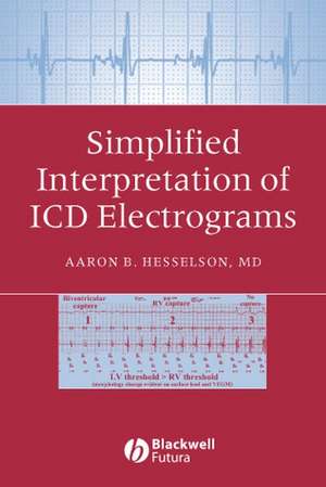 Simplified Interpretation of ICD Electrograms de AB Hesselson