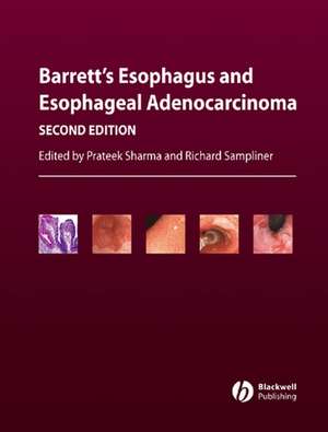 Barrett′s Esophagus and Esophageal Adenocarcinoma 2e de P Sharma