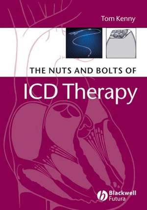 The Nuts and Bolts of ICD Therapy de T Kenny