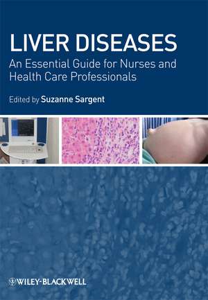 Liver Diseases – An Essential Guide for Nurses and Health Care Professionals de S Sargent