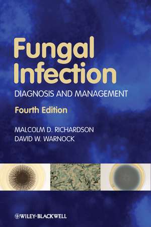 Fungal Infection: Diagnosis and Management de Malcolm D. Richardson