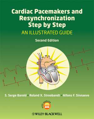 Cardiac Pacemakers and Resynchronization Step by Step – An Illustrated Guide 2e de SS Barold