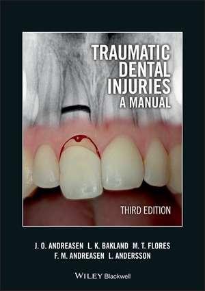 Traumatic Dental Injuries – A Manual 3e de J Andreasen