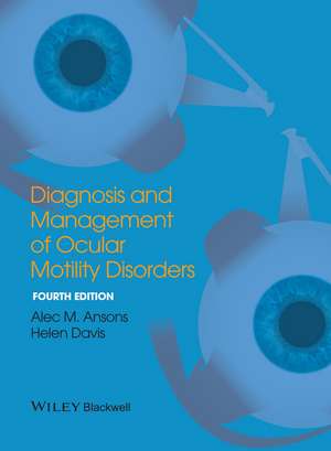 Diagnosis and Management of Ocular Motility Disorders 4e