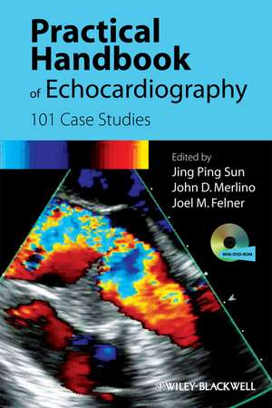 Practical Handbook of Echocardiography – 101 Case Studies de JP Sun