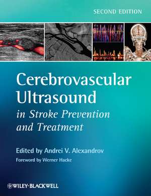 Cerebrovascular Ultrasound in Stroke Prevention and Treatment de Andrei V. Alexandrov