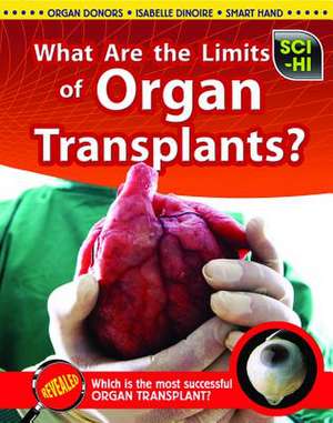 What Are the Limits of Organ Transplants? de Anna Claybourne