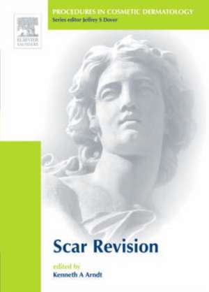 Procedures in Cosmetic Dermatology Series: Scar Revision de Kenneth A. Arndt