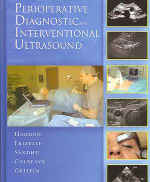 Perioperative Diagnostic and Interventional Ultrasound with DVD de Dominic Harmon