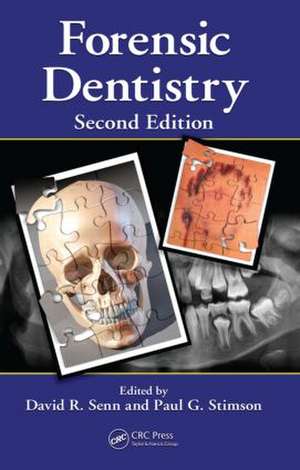 Forensic Dentistry de David R. Senn