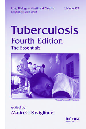 Tuberculosis: The Essentials, Fourth Edition de Mario C. Raviglione