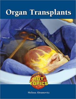 Organ Transplants de Melissa Abramovitz