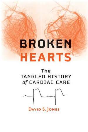 Broken Hearts de David S Jones