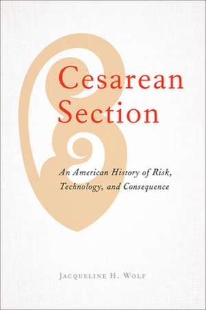 Cesarean Section – An American History of Risk, Technology, and Consequence de Jacqueline H. Wolf