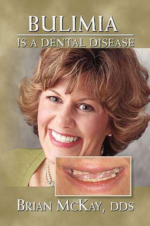 Bulimia Is a Dental Disease de Brian Dds McKay