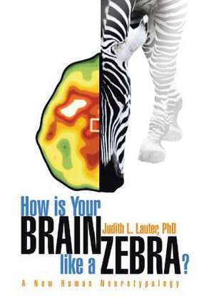 How Is Your Brain Like a Zebra? de Judith L. Lauter