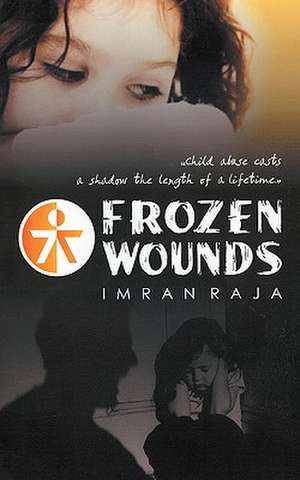 Frozen Wounds de Imran Raja