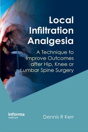 Local Infiltration Analgesia: A Technique to Improve Outcomes after Hip, Knee or Lumbar Spine Surgery de Dennis R. Kerr