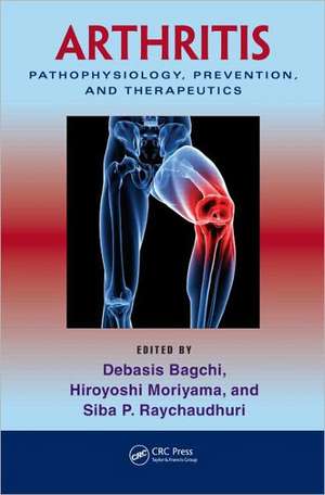 Arthritis: Pathophysiology, Prevention, and Therapeutics de Debasis Bagchi