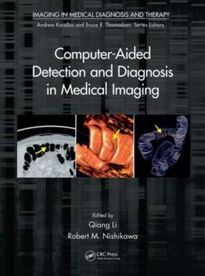 Computer-Aided Detection and Diagnosis in Medical Imaging