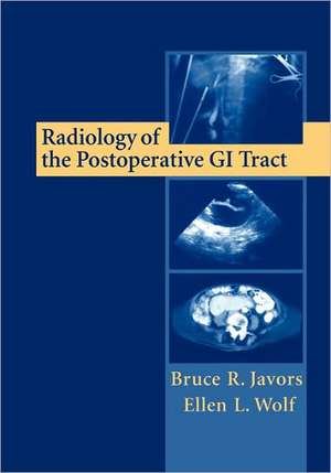 Radiology of the Postoperative GI Tract de Bruce R. Javors