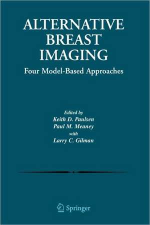 Alternative Breast Imaging: Four Model-Based Approaches de Keith D. Paulsen