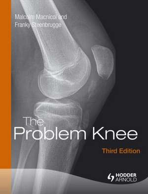 The Problem Knee de Malcolm F. MacNicol