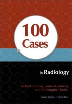 100 Cases in Radiology de Robert Thomas