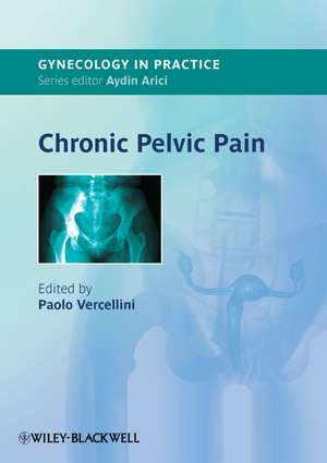 Chronic Pelvic Pain de P Vercellini