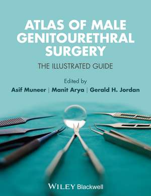 Atlas of Male Genitourethral Surgery – The Illustrated Guide de A Muneer