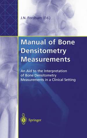 Manual of Bone Densitometry Measurements: An Aid to the Interpretation of Bone Densitometry Measurements in a Clinical Setting de John N. Fordham