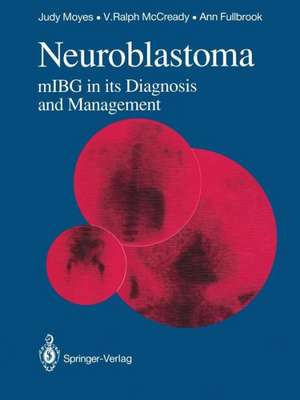 Neuroblastoma: mIBG in its Diagnosis and Management de Sue L. Fielding