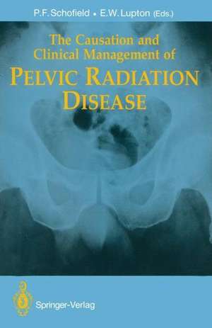 The Causation and Clinical Management of Pelvic Radiation Disease de Philip F. Schofield