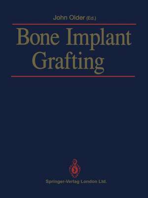 Bone Implant Grafting de John Older