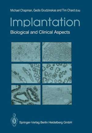 Implantation: Biological and Clinical Aspects de Michael G. Chapman