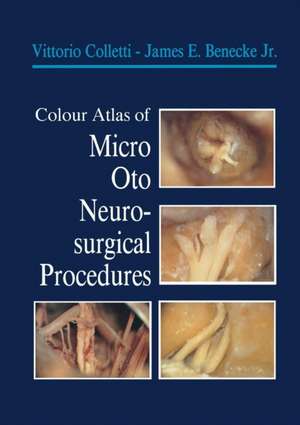 Colour Atlas of Micro-Oto-Neurosurgical Procedures de Vittorio Colletti