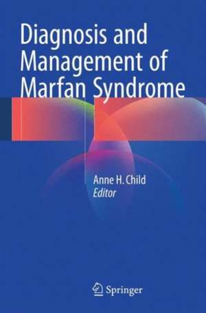 Diagnosis and Management of Marfan Syndrome de Anne H. Child