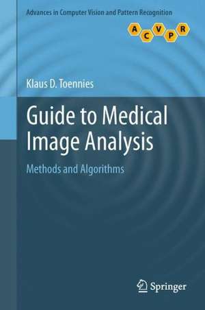 Guide to Medical Image Analysis: Methods and Algorithms de Klaus D. Toennies